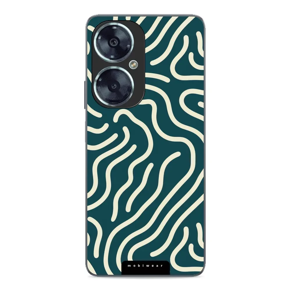 Hülle Glossy Case für Huawei Nova 11i - Farbe GA61G