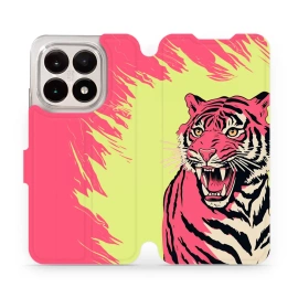 Hülle für Xiaomi 15T - Farbe VP51S