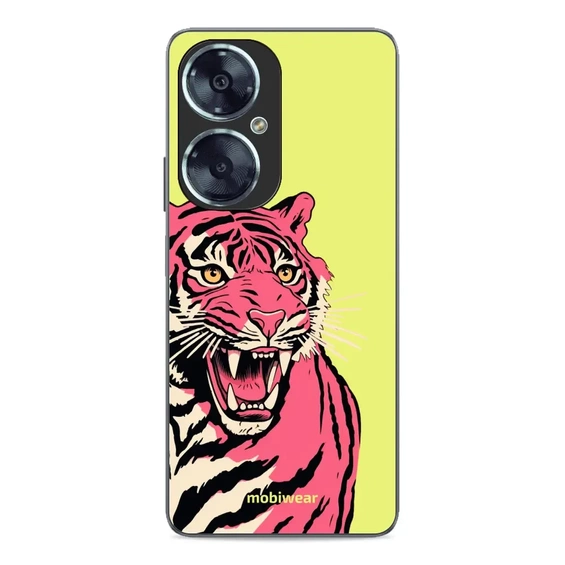 Hülle Glossy Case für Huawei Nova 11i - Farbe G051G
