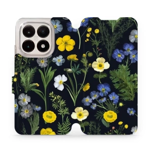 Hülle für Xiaomi 15T - Farbe VP47S