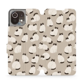 Hülle für Xiaomi Mi 11 Lite - Farbe V160S