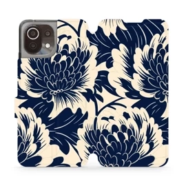 Hülle für Xiaomi Mi 11 Lite - Farbe VA40S