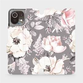 Hülle für Xiaomi Mi 11 Lite - Farbe MX06S