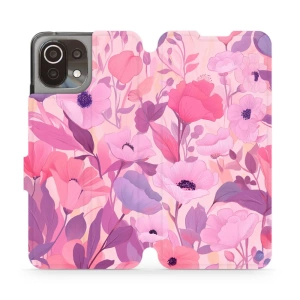 Hülle für Xiaomi Mi 11 Lite - Farbe VP74S