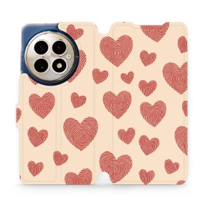 Hülle für OnePlus 13 - Farbe VP93S