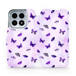 Hülle für Xiaomi 17 - Farbe VP76S