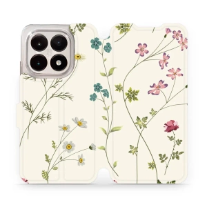 Hülle für Xiaomi 15T - Farbe MD03S