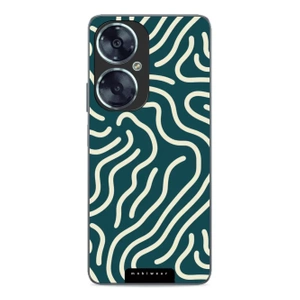 Hülle Glossy Case für Huawei Nova 11i - Farbe GA61G