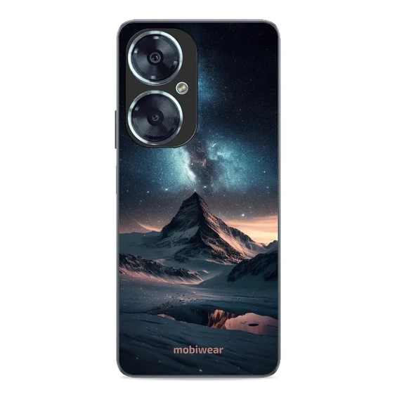 Hülle Glossy Case für Huawei Nova 11i - Farbe G006G
