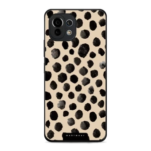 Hülle Glossy Case für Xiaomi Mi 11 Lite - Farbe GA50G
